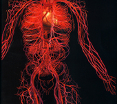 Диагностика эластичности артерий по данным скорости пульсовой волны рисунок